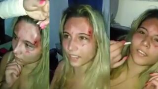Side Chick Got Caught, Gets Beaten and Face Burned by Dudes GF