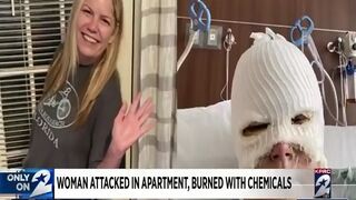 Houston Woman Has Acid Thrown in her Face by Unknown Man Inside her own Apartment.
