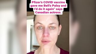 Mental Patient Actress Shows off Horrific Side Effects from Vaccine. "Id do it again"