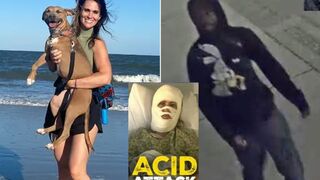 The son of the woman who was RANDOMLY attacked with acid speaks out
