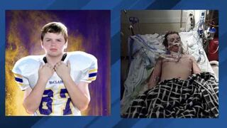 13-Year-Old Dies From Overdose After Attempting TikTok Benadryl Challenge!