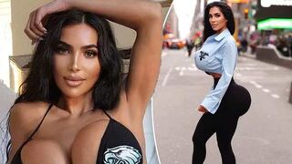Kim Kardashian Look-Alike Dies Of Cardiac Arrest After Plastic Surgery!