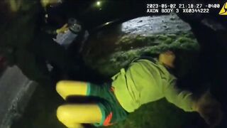 DAMN: Cops Shatter Woman's Arm During Arrest.