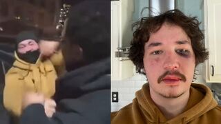 Kick Streamer Waxiest ATTACKED at the Minneapolis anti-ICE protest (another angle)