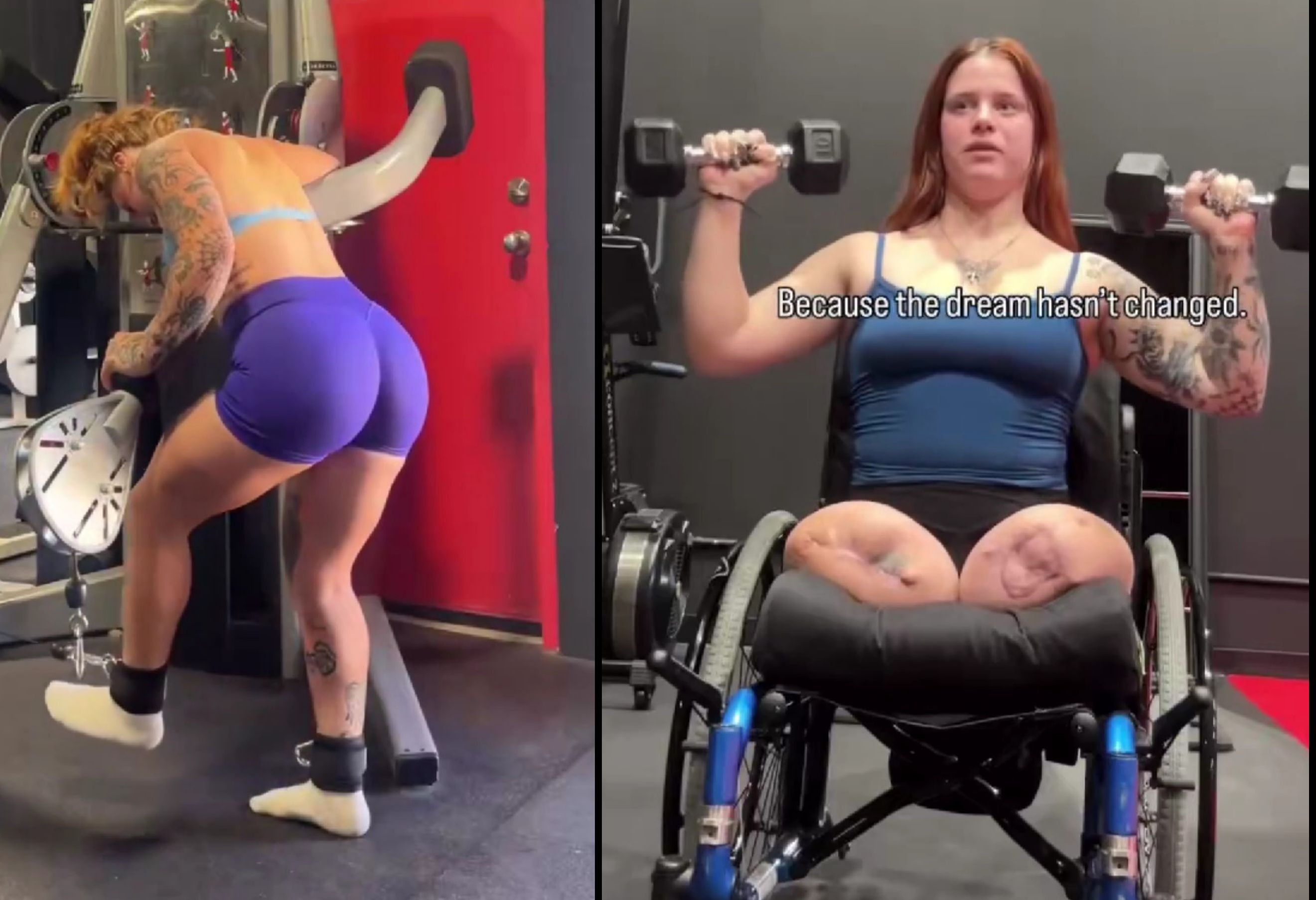 Heartbreaking: Woman opens up about how she lost both her legs.