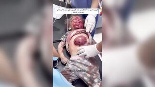 Warning: Inside a Palestinian Hospital....15 Second Warning