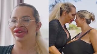 Influencer couple with extreme plastic surgeries announces pregnancy