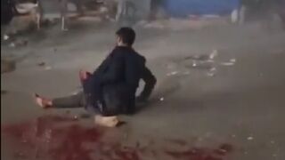 The Moment an Airstrike hits Gaze takes Off Man's Leg (Graphic Warning)