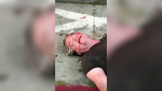 White Man is Savagely Beaten into a Coma in Oakland, California.