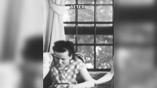 Mental History: Creepy Footage shows Before and After of a Lipotomy