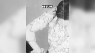 Mental History: Creepy Footage shows Before and After of a Lipotomy