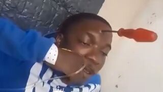 Kid brought into Emergency with Screwdriver through His Head