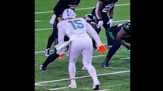 OUCH: You Can See Dolphins Linebacker Jaelan Phillips Achilles Heel Snap Off.... (Not for the Squeamish)