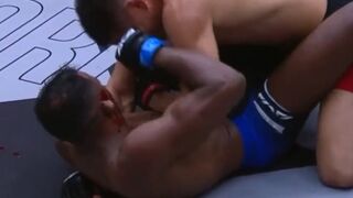 MMA Fighter gets his Ear Ripped Off during Fight