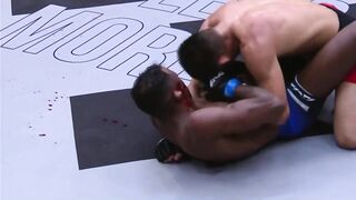 MMA Fighter gets his Ear Ripped Off during Fight