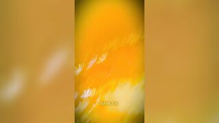 When will the UK & Europe take action?