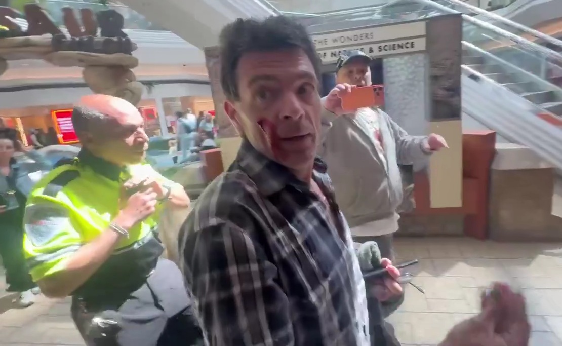 Predator wipes blood after trying to assault a lil boy child