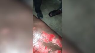 Nigerian Man is Pain Tortured by Acid and Salt then the Machete (Watch until End)