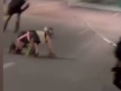 The Worst Road Burn Ever on her Knees