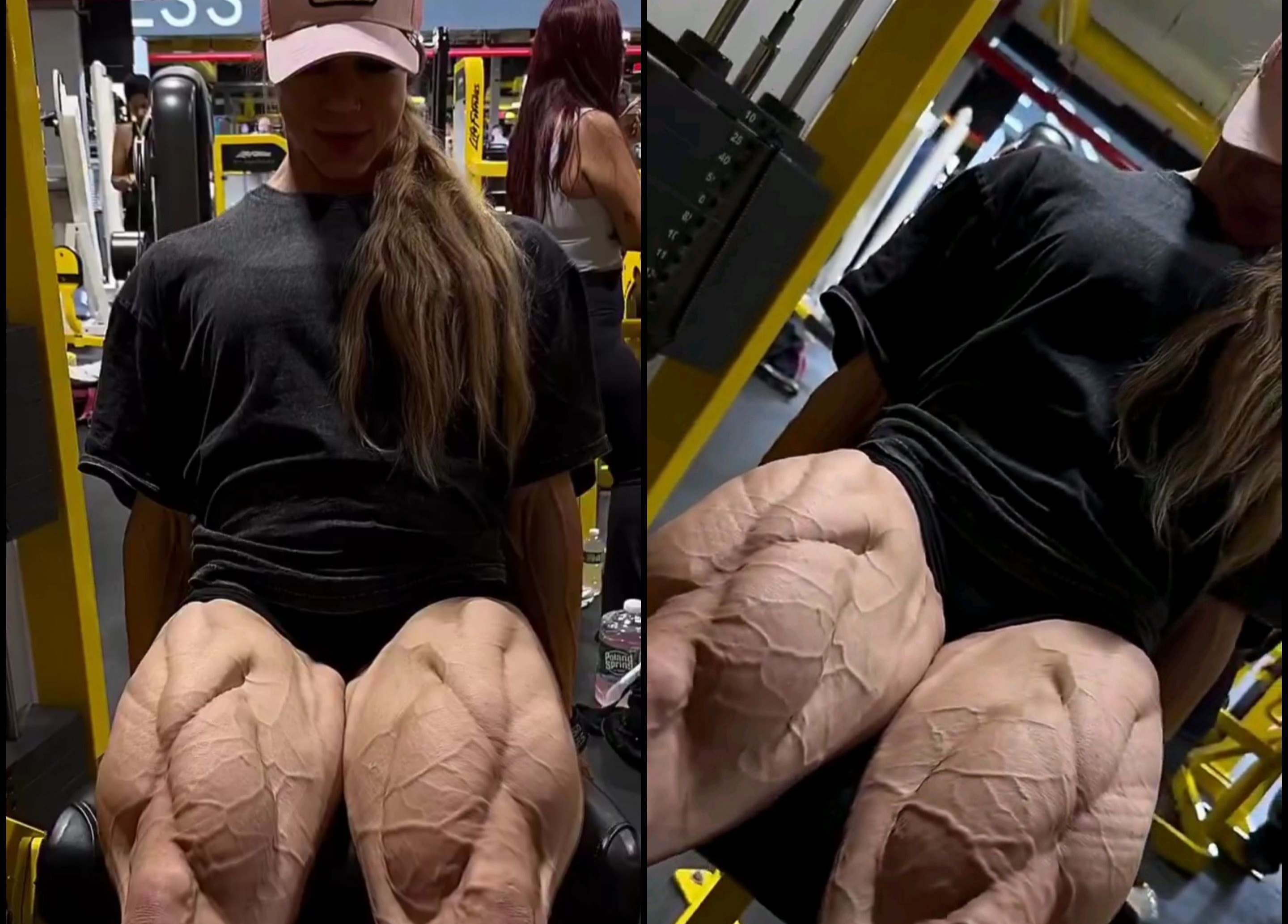 Her veins look like lightening bolts