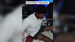 Video shows Man with Rabies Hydrophobia, Scared of Water, a Symptom of Rabies (See info)