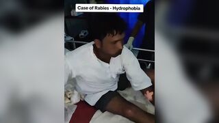 Video shows Man with Rabies Hydrophobia, Scared of Water, a Symptom of Rabies (See info)