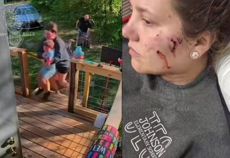 A mother went full mommy mode the second her pit bull attacked her son
