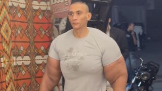 Arms enhanced with synthol look unnatural and unappealing