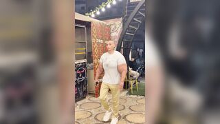 Arms enhanced with synthol look unnatural and unappealing