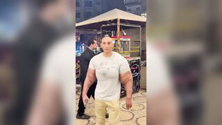 Arms enhanced with synthol look unnatural and unappealing