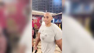 Arms enhanced with synthol look unnatural and unappealing
