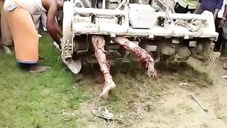 This Man is Still somehow Alive...Gruesome Farm Accident