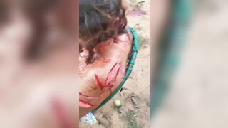 Woman Suffering after being Chopped up with Machete Barely Alive