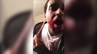 Stupid Stupid Kid puts Knives and maybe a Sword to his Face. The Bleeding gets Worse