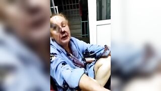 Wild: Woman in Wheel Chair has Knife Embedded through Her Head sits in Waiting Room