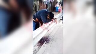 Strong Images: Man in Nicaragua has Guts Ripped Open after Accident..He is Given Last Rights as he Bleeds Out