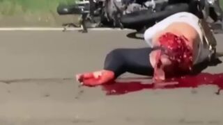 Strong Images: 22 Year Old Woman loses Her Leg in Tragic Motorcycle Accident and is Filmed while Suffering (See Info for Tragic Story)