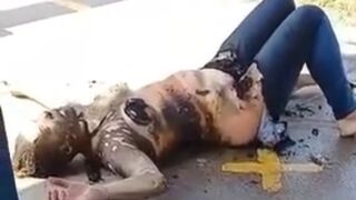 New Video of Woman Burned shows Her Talking to Cameraman before her Death