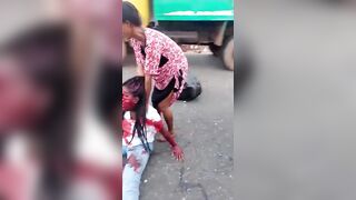 Hard to Watch Video of Woman who Lost her Face in Bad Accident Yelling for Help