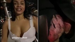 Ok, This Girl has Ass Road Rash just as Bad...as the first Guy