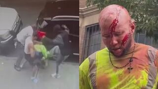 Man Who Stabbed His Baby Mama Gets Jumped by Locals in NYC