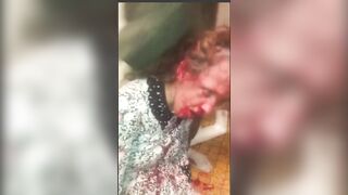 WITH Audio but Bizarre Video of Sickly Skinny Woman being Abused