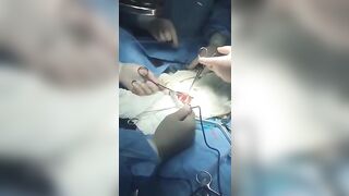 Doctors Remove 3 Foot Long Dildo from Man's Intestines..He said he "Accidentally" Fell On It.