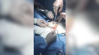 Doctors Remove 3 Foot Long Dildo from Man's Intestines..He said he "Accidentally" Fell On It.