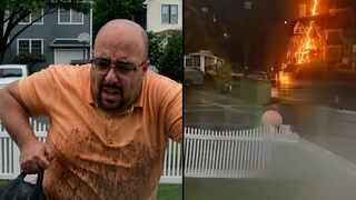 Staten Island man struck by lightning while walking to a dentist appointment.