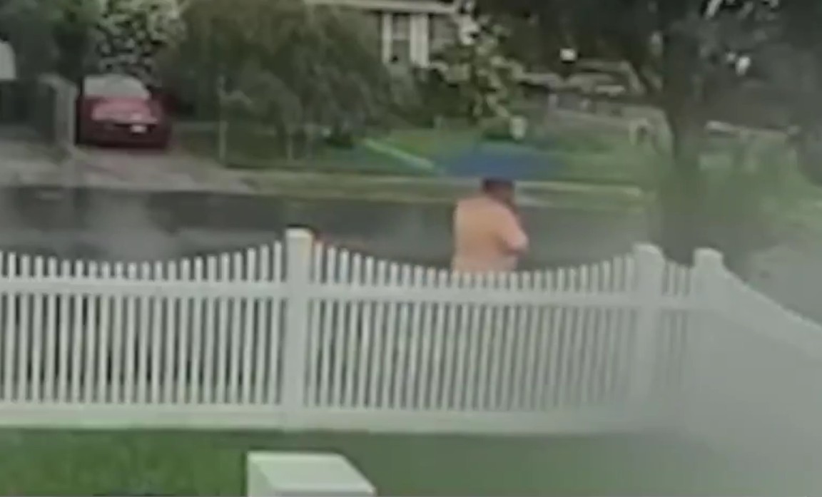 WILD VIDEO out of New York this morning. A Staten Island man is walking to the DENTIST with an umbrella… and lightning hits him in the FOOT.