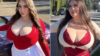 ALERT: Woman suffers from a rare condition that makes her breasts never stop growing