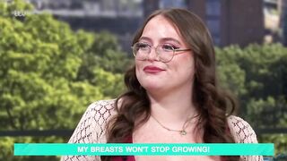 ALERT: Woman suffers from a rare condition that makes her breasts never stop growing