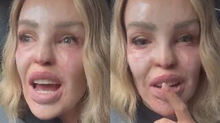 British TV Personality And Acid Attack Survivor,Opens Up About Cruel Comments After NTAs Red Carpet Appearance