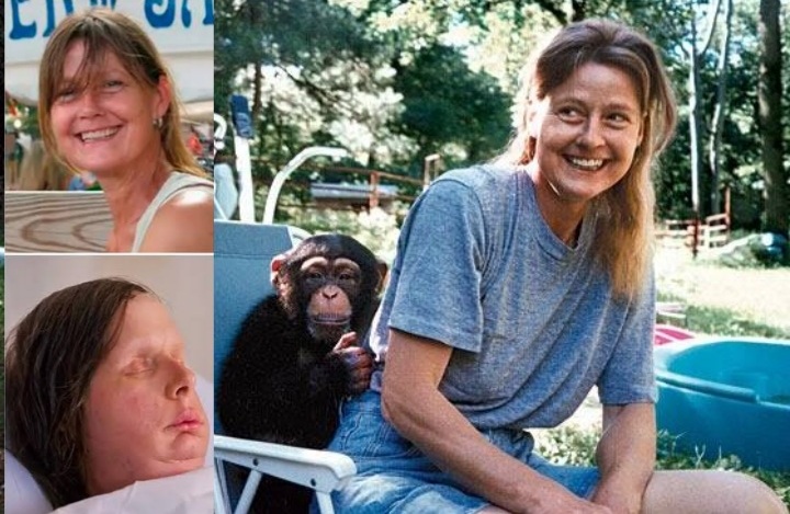 Travis the Chimp terrifying 911 call.